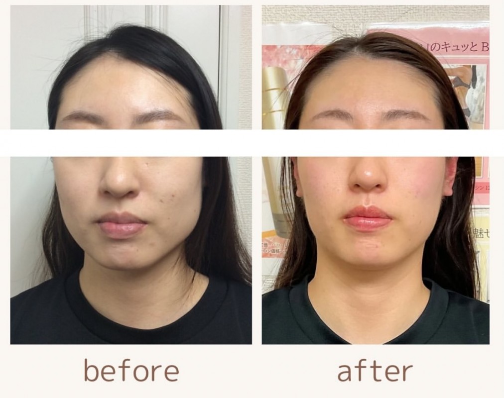 IMG-2939-e1768562414144